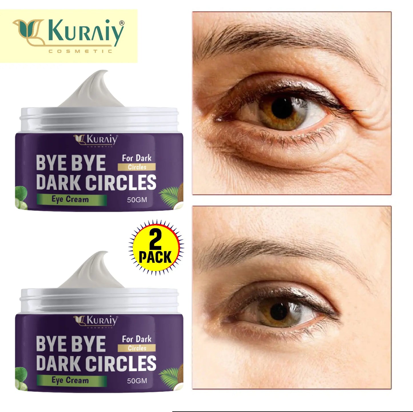 Bye Bye Dark Circle Cream- Korean Made